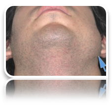 collage image title