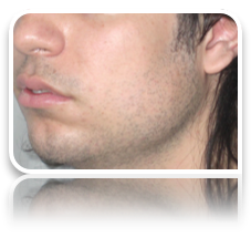 collage image title